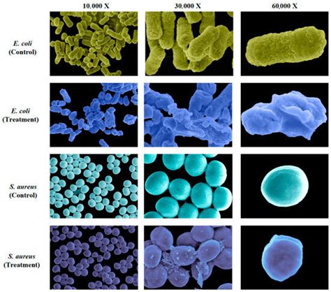 Squama Manitis Extract Exhibits Broad-Spectrum Antibacterial Activity ...