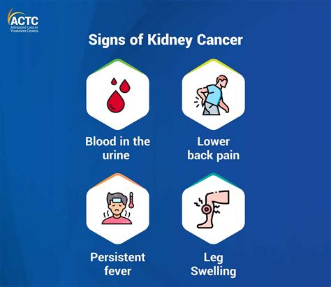 Kidney Cancer: Warning Signs, Tests & Next Steps | ACTC Health