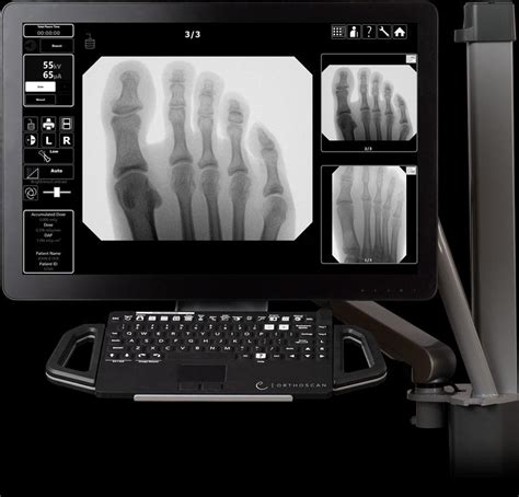 Image result for Fluoroscopy Screen