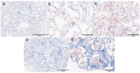 Histopathological and Proteomics Analysis of Shrimp Litopenaeus ...