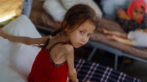 War on Gaza: Hunger 'worse than bombings' for starving Palestinians | Middle East Eye