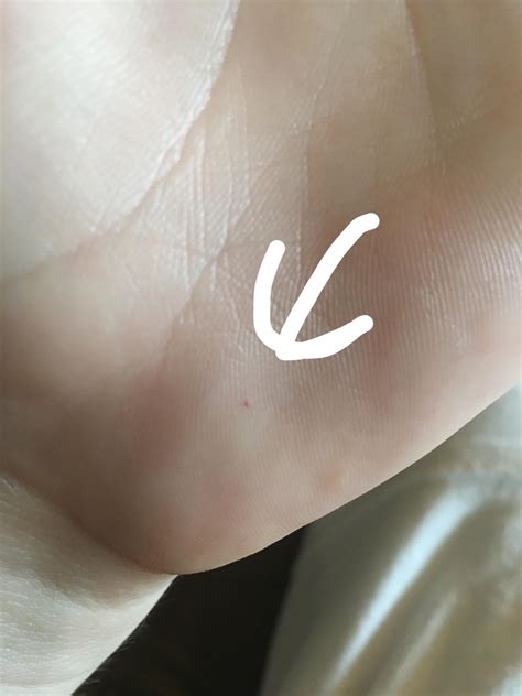 Small red dots appearing on skin what are they? : r/SkincareAddicts