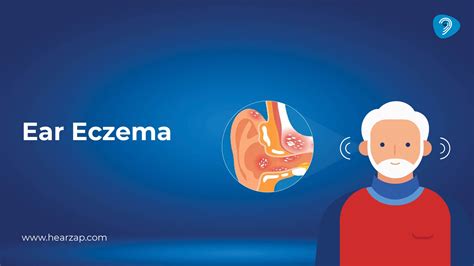 Ear Eczema Guide: Signs, Causes & Best Treatment Options
