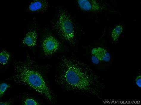 PADI4/PAD4 antibody (17373-1-AP) | Proteintech