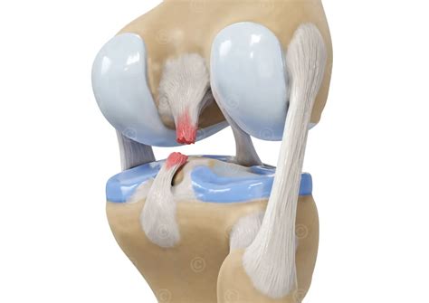 Illustrations knee and meniscus - MedicalGraphics