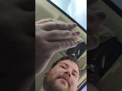 Exploding Pimples 2018 的图像结果