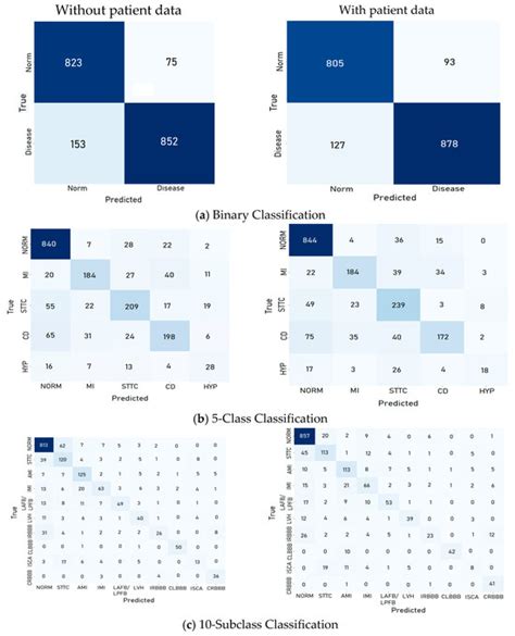 Interpretable Deep Learning Models for Arrhythmia Classification Based ...