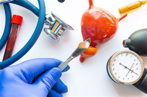 Life Expectancy after TURP Surgery - Bottom Line, Inc.