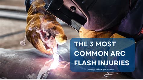 The 3 Most Common Arc Flash Injuries