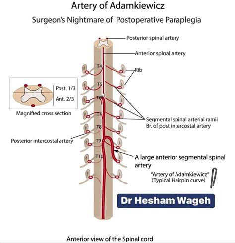 Artery Of Adamkiewicz