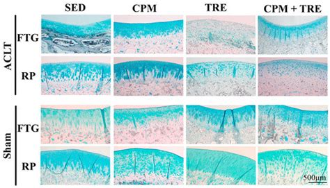 Can Early Rehabilitation Prevent Posttraumatic Osteoarthritis in the ...