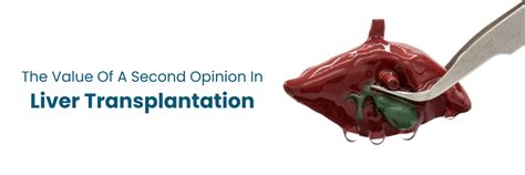 Know The Second Opinion Value in Liver Transplantation
