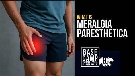 Meralgia paresthetica — Sports Chiropractor Vernon BC