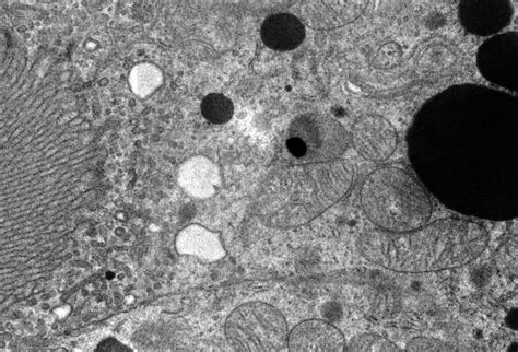Transmission Electron Microscopy in Life Sciences – JEOL