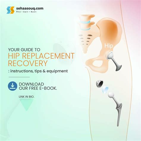 Hip Replacement Recovery- Tips And More | by Sehaasouq | Medium