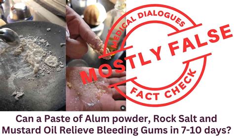 Fact Check: Can a Paste of Alum powder, Rock Salt and Mustard Oil ...