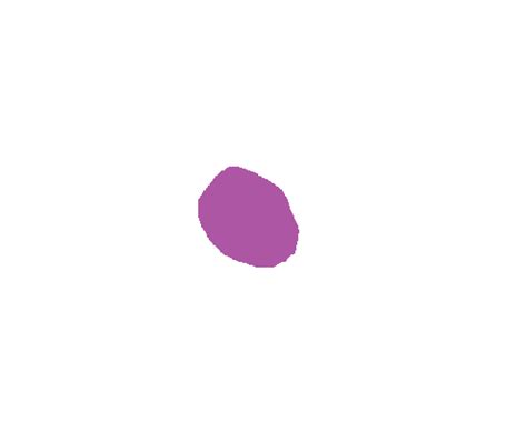 Fine Grained Polyp - Dataset Ninja
