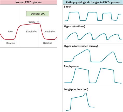 18.3: Factors Affecting Cardiopulmonary Function - Medicine LibreTexts