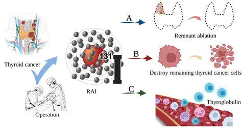 Thyroid Cancer Cells