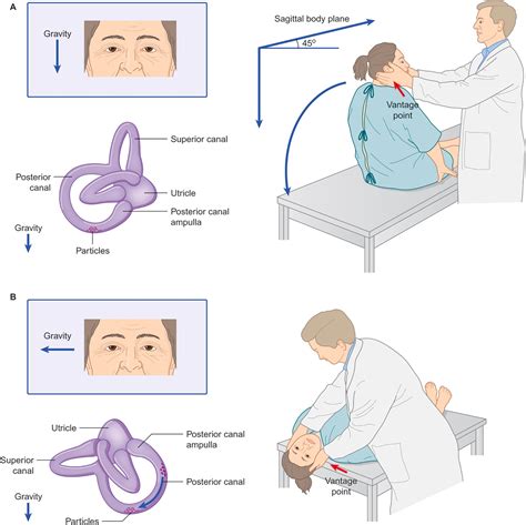 Otoneurologic Manifestations of Otologic and Systemic Disease ...