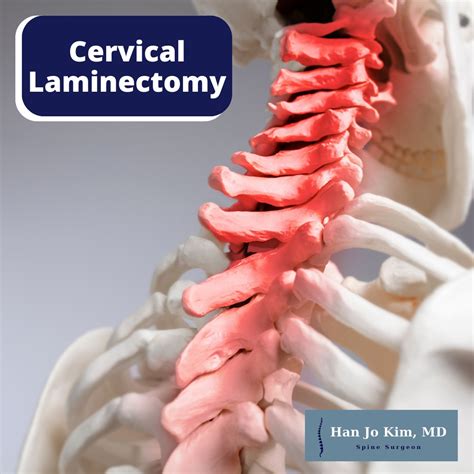 Dr. Han Jo Kim, MD, Orthopedist | Orthopaedic Surgery of the Spine in ...