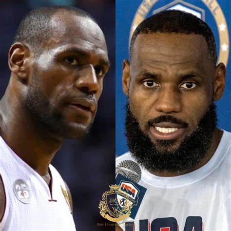 LeBron James Hair Transplant | Rumours of King James Hair - Hair Center ...