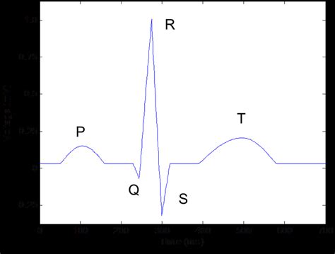 ECG Simulator Using MATLAB 的图像结果