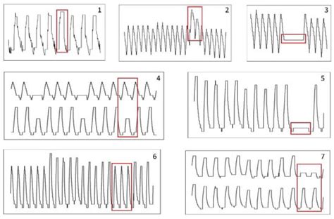 Anomaly Detection in Satellite Telemetry Data Using a Sparse Feature ...