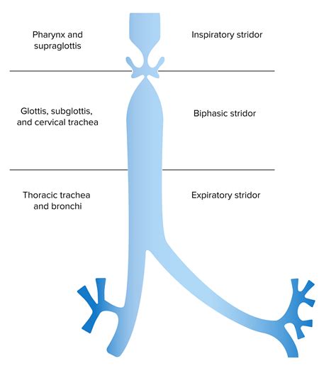 Laringomalacia y Traqueomalacia | Concise Medical Knowledge
