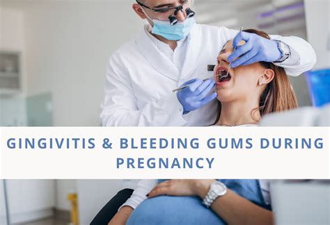 Gingivitis and Bleeding Gums During Pregnancy - Jenni Jenkins