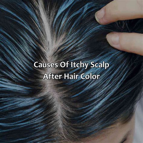 What Helps Itchy Scalp After Hair Color - colorscombo.com