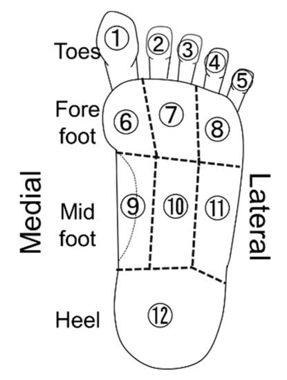 Relationship between Plantar Pressure and Sensory Disturbance in ...