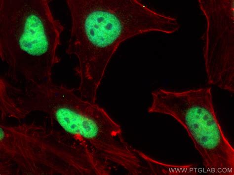 BRM/SMARCA2-Specific antibody (26613-1-AP) | Proteintech