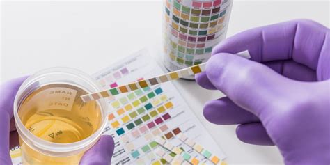 La orina de las personas con diabetes: ten cuidado si tiene este color