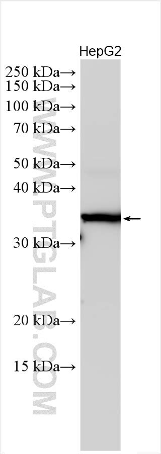 OTUB1 antibody (10573-1-AP) | Proteintech