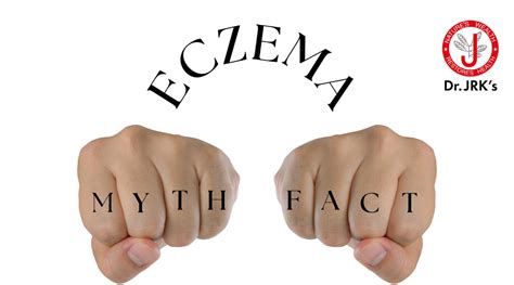 ECZEMA - MYTHS AND FACTS – Dr.JRK's Research and Pharmaceuticals