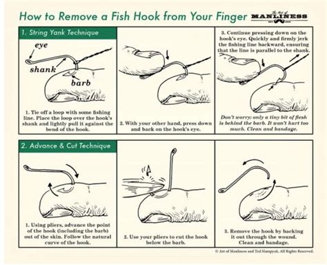 Image result for String Yank Method
