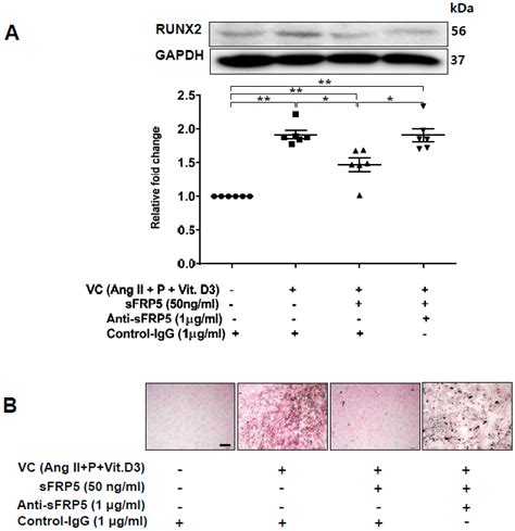 Reduction of Secreted Frizzled-Related Protein 5 Drives Vascular ...