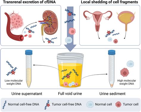 Unlocking the potential of tumor‐derived DNA in urine for cancer ...