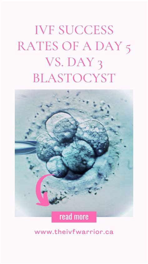 IVF Success Rates of a Day 5 vs. Day 3 Blastocyst | Fresh embryo ...