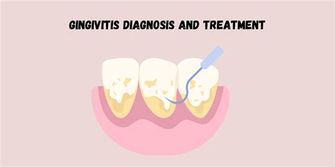 Understanding Gingivitis (Gum Disease): Symptoms, Causes, & Treatments - PUREXA Oral Care