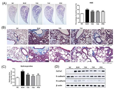 Theophylline Attenuates BLM-Induced Pulmonary Fibrosis by Inhibiting ...