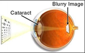 Oculus Eye Hospital :: Eye Care Centre in Jalandhar