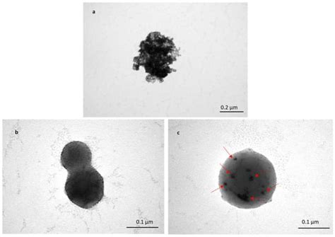 Microneedle-Assisted Transfersomes as a Transdermal Delivery System for ...