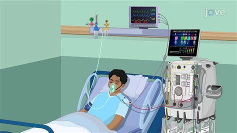 Video: Continuous Renal Replacement Therapy