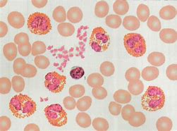 Image result for 嗜酸性细胞