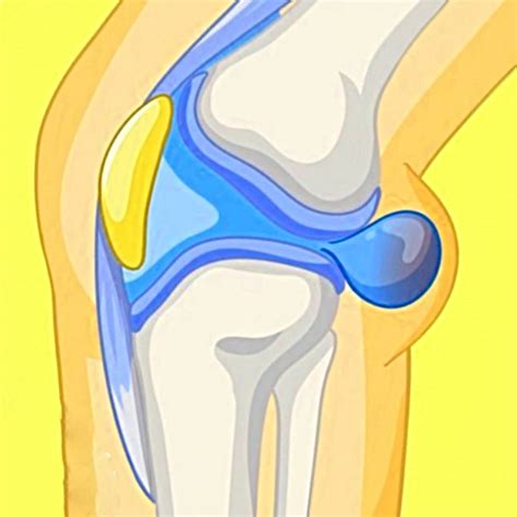 Baker’s Cyst: The back-of-the-knee bulge that reveals more - Oregon Regenerative Medicine