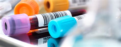 Complement component 3 (C3)