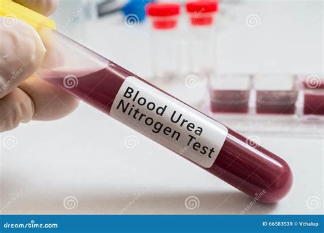 Urea Nitrogen Blood Bun