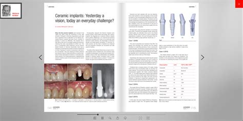 ISMI | INTERNATIONALE GESELLSCHAFT FÜR METALLFREIE IMPLANTOLOGIE e.V.